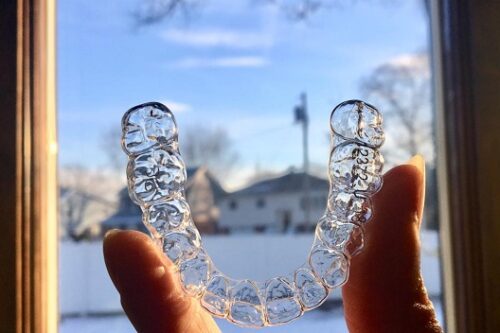 Piano Di Protezione Del Sorriso