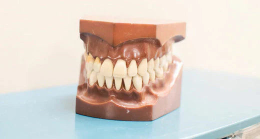 Primo piano di un modello dentale che mostra una serie di denti dritti.