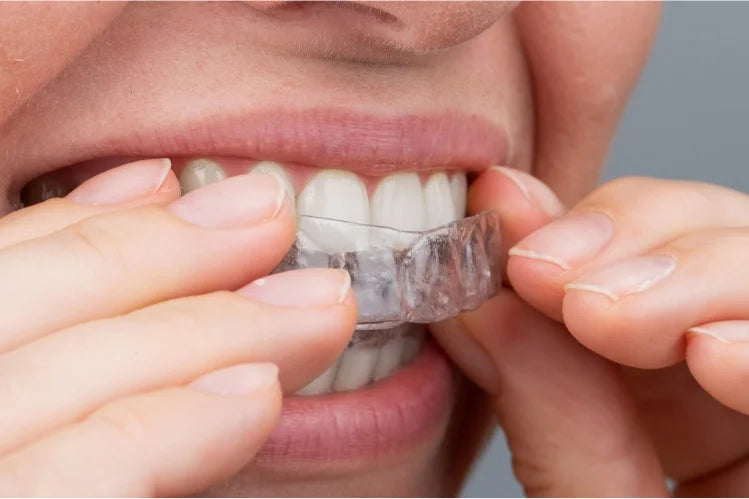 Comprendi la differenza tra allineamento e raddrizzamento dei denti, perché è importante e come ciascuno di essi può migliorare il tuo sorriso e la salute orale.