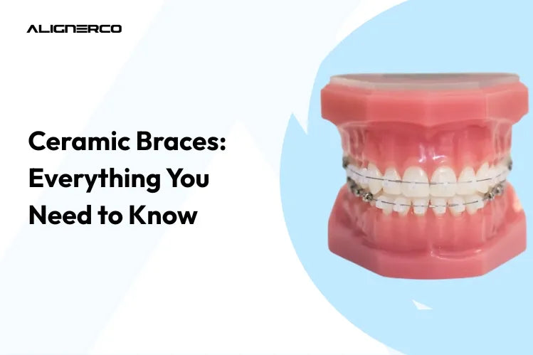 Apparecchi in ceramica su un modello di denti