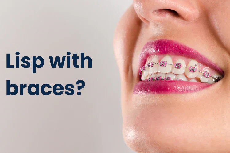 Un'immagine di una donna con l'apparecchio ortodontico