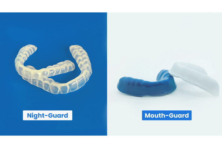 Types of Mouth Guads & How They Protect Your Teeth