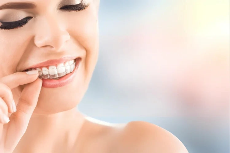clear aligners