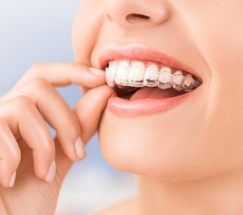 Vantaggio Sorriso Plus