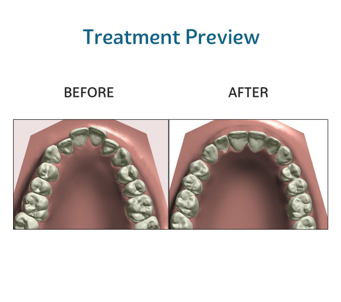 Vantaggio notturno più